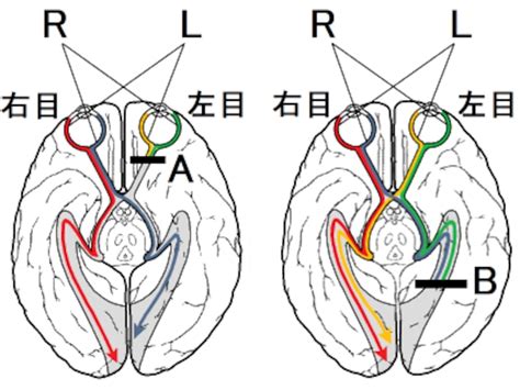 視交叉城郭|視神経の半交叉・視覚伝導路の仕組みをわかりやすく。